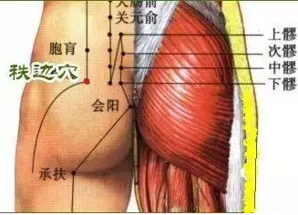 坐骨神经痛